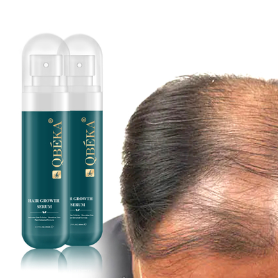 80 ml de sérum à base de plantes anti-chute des cheveux pour la prévention de la perte de cheveux
