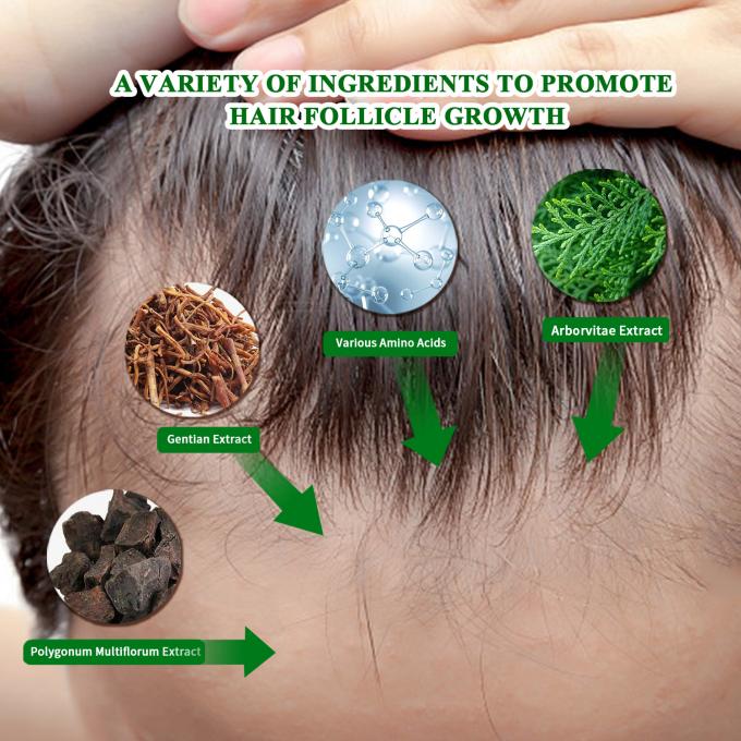 Serum organique de croissance des cheveux Utilisation externe Traitement de repousse des cheveux Spray anti-chute de cheveux 80 ml 0