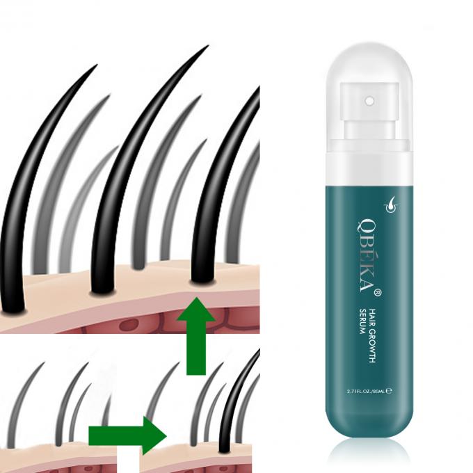 80 ml d'huile de croissance des cheveux Produit de marque privée Équipe professionnelle de contrôle qualité sérum anti-chute des cheveux 0