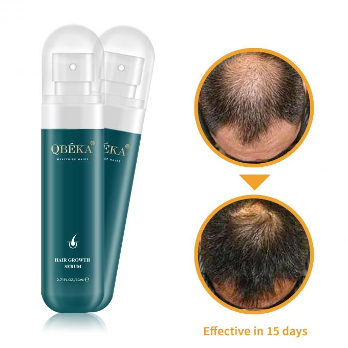 80 ml d'huile de croissance des cheveux Produit de marque privée Équipe professionnelle de contrôle qualité sérum anti-chute des cheveux 1