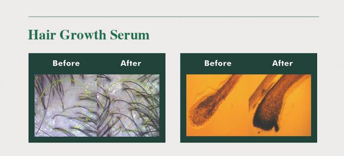 Tonic à base de plantes pour les hommes Prévient la perte de cheveux repousse les cheveux Améliorer le volume 3 mois de fourniture 2