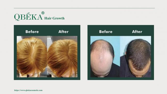 GMPC Standard Shampooing de prévention de la perte de cheveux pour la perte de cheveux et le traitement de l'amincissement 80m 10