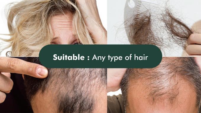 GMPC Standard Shampooing de prévention de la perte de cheveux pour la perte de cheveux et le traitement de l'amincissement 80m 12