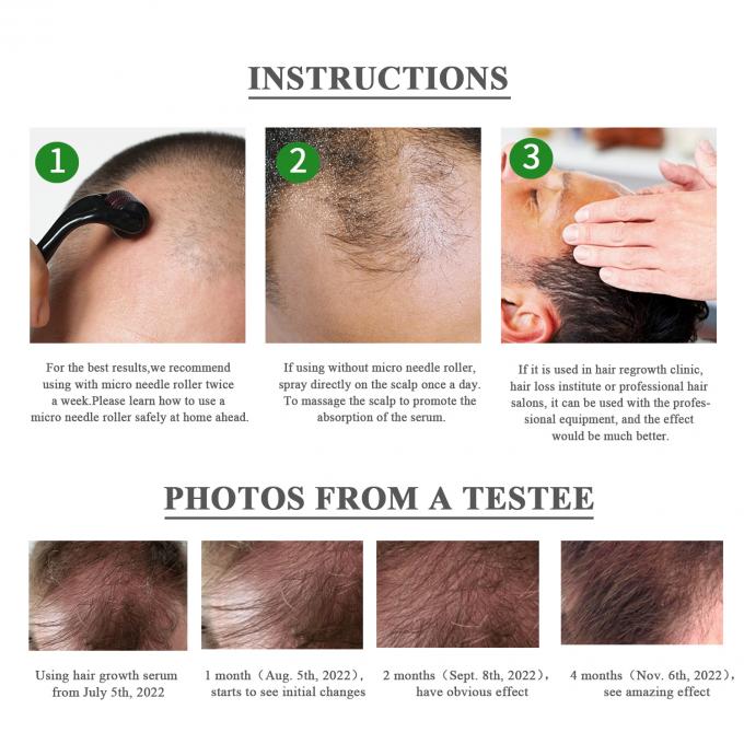 Serum de croissance des cheveux à base de plantes 7-15 jours Restaurer le volume et l'éclat de vos cheveux sans effort 3