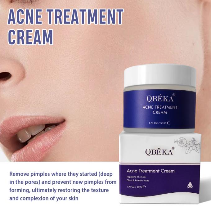 Crème naturelle organique pour le traitement de l' acné Quantité 1000 2