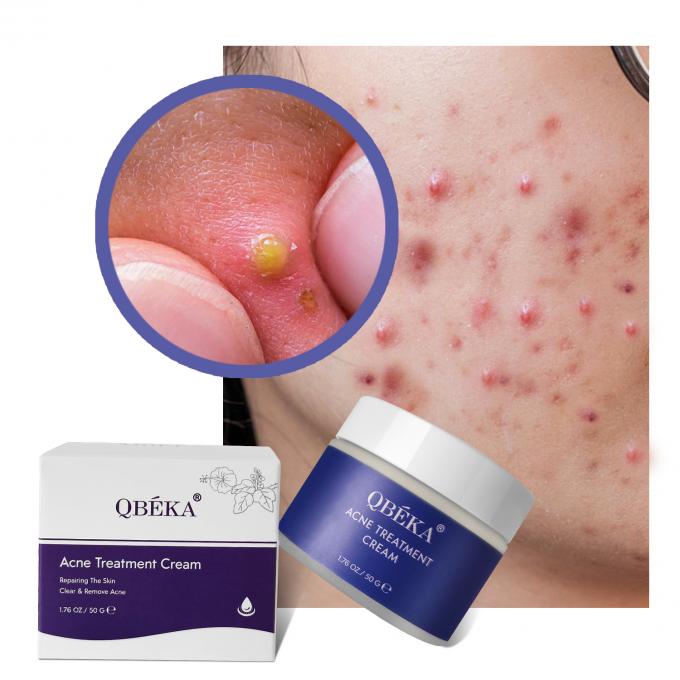 Crème efficace contre l' acné au thé vert pour femme en vrac 1