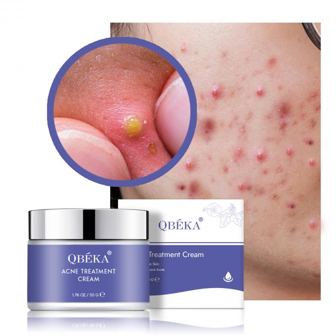 Crème contre l' acné tache noire ensemble à base de plantes vitamine C scintille les cicatrices pour la revitalisation de la peau féminine 0