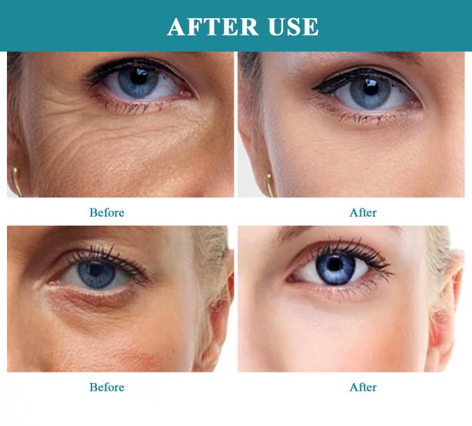 Serum d'huile et d'humidité à effets multiples La solution ultime pour les soins de la peau de taille normale 5
