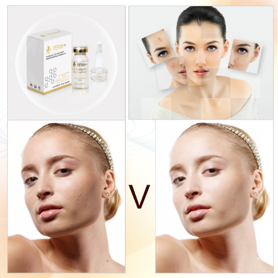 Ampoules de taille régulière de vitamine C organique purifiante blanchissante anti taches de rousseur Quantité 1000 1