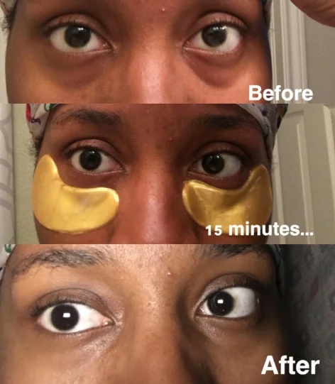 Masque hydratant pour les yeux pour réduire les rides et les rides 6
